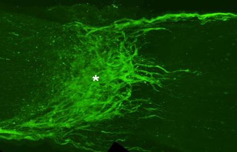 optic nerve crush