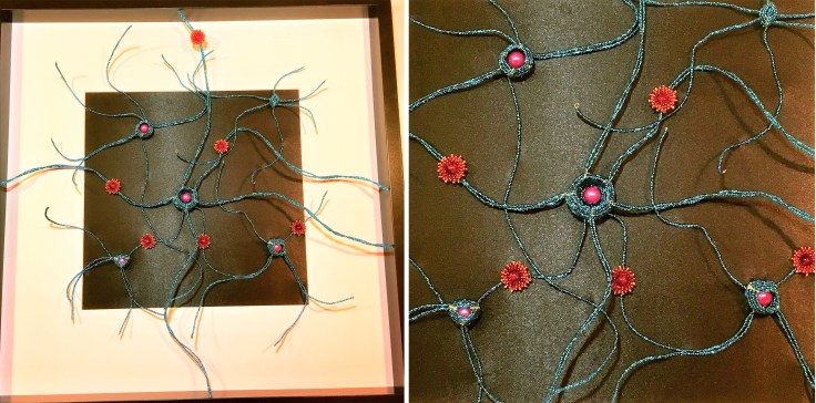 The Internal Storm_epilepsy_joint