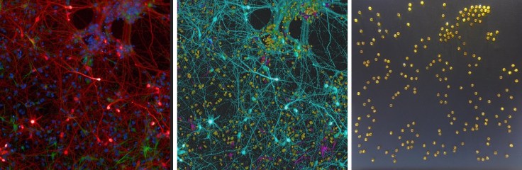 from_microscope_to_beads