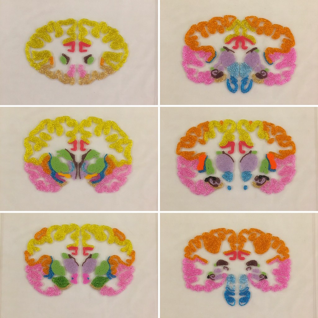 Six individual plexiglass panels with beaded human brain sections displayed as wall art